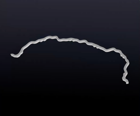Festsitzende Retainer